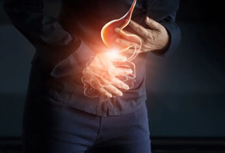Stomach Ulcers Graphic