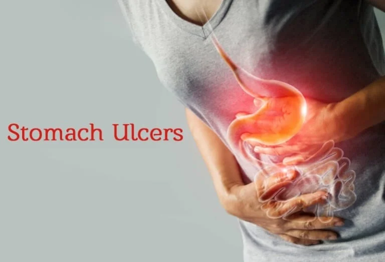 Severe Core Gastric Inflammation
